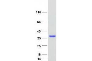 Western Blotting (WB) image for Single-Strand-Selective Monofunctional Uracil-DNA Glycosylase 1 (SMUG1) protein (Myc-DYKDDDDK Tag) (ABIN2732266)