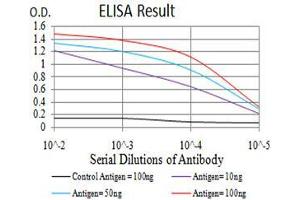 Black line: Control Antigen (100 ng),Purple line: Antigen (10 ng), Blue line: Antigen (50 ng), Red line:Antigen (100 ng) (OTUD4 抗体  (AA 815-1049))