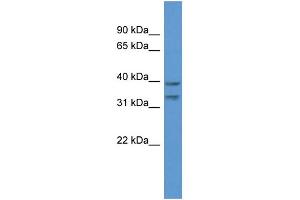 WB Suggested Anti-BRMS1L Antibody Titration: 1. (BRMS1L 抗体  (C-Term))