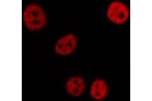 ABIN6276993 staining  Hela cells by IF/ICC. (RPL5 抗体  (Internal Region))