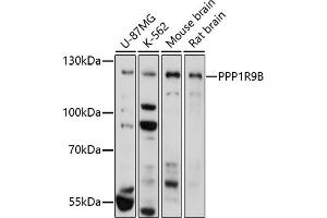 Western blot analysis of extracts of various cell lines, using PPP1R9B antibody (ABIN7269680) at 1:1000 dilution. (PPP1R9B 抗体)