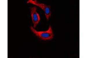 Immunofluorescent analysis of Ryanodine Receptor 2 (pS2808) staining in U251 cells. (RYR2 抗体  (pSer2808))