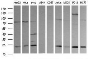 Image no. 3 for anti-RAB30, Member RAS Oncogene Family (RAB30) antibody (ABIN1500559) (RAB30 抗体)