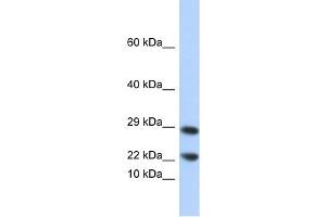 Lipocalin 8 antibody used at 1 ug/ml to detect target protein. (LCN8 抗体  (N-Term))