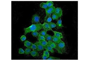 anti-Budding Uninhibited By Benzimidazoles 1 Homolog beta (Yeast) (BUB1B) (AA 26-448) antibody