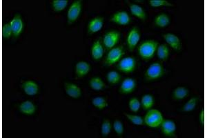 Immunofluorescence (IF) image for anti-Acyl-CoA Dehydrogenase, Very Long Chain (ACADVL) (AA 403-497) antibody (ABIN7175433)