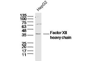 Human HepG2 cells probed with Factor XII heavy chain Polyclonal Antibody, unconjugated  at 1:300 overnight at 4°C followed by a conjugated secondary antibody at 1:10000 for 90 minutes at 37°C.