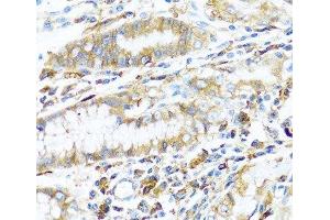 Immunohistochemistry of paraffin-embedded Human stomach using HLA-DPB1 Polyclonal Antibody at dilution of 1:100 (40x lens). (HLA-DPB1 抗体)