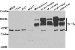 Western blot analysis of extracts of various cell lines, using SP100 antibody. (SP100 抗体)