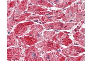 Anti-SLC4A3 / AE3 antibody IHC staining of human heart.