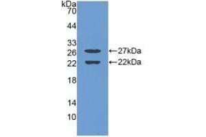 Western blot analysis of recombinant Mouse EGR1.