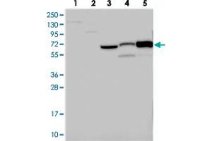 Western blot analysis of Lane 1: RT-4, Lane 2: U-251 MG, Lane 3: Human Plasma, Lane 4: Liver, Lane 5: Tonsil with CNNM1 polyclonal antibody . (Cyclin M1 抗体)