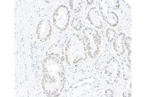 Immunohistochemistry (IHC) image for anti-AT Rich Interactive Domain 1A (SWI-Like) (ARID1A) (AA 750-800) antibody (ABIN7795677)
