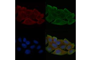 ABIN6258081 and ABIN6274661 staining Hela cells(30 min of UV treatment) by IF/ICC.
