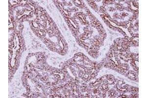 Image no. 1 for anti-3-hydroxyisobutyrate Dehydrogenase (HIBADH) (AA 1-257) antibody (ABIN1501919) (HIBADH 抗体  (AA 1-257))