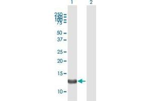 Western Blotting (WB) image for anti-FERM, RhoGEF (ARHGEF) and Pleckstrin Domain Protein 1 (Chondrocyte-Derived) (FARP1) (AA 1-129) antibody (ABIN2565522)