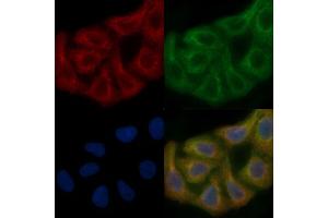 PMPCA Mouse Monoclonal Antibody staining Hela cells by IF/ICC. (PMPCA 抗体)