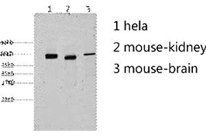 Western blot analysis of 1) Hela, 2) mouse kidney, 3) mouse brain, diluted at 1:2000. (Cytokeratin 7 抗体)