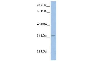ECHDC2 antibody used at 1 ug/ml to detect target protein. (ECHDC2 抗体  (Middle Region))