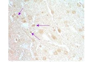 Rat brain tissue was stained by Rabbit Anti-Neuromedin S Prepro (70-103) (Rat) Serum (NMS 抗体  (Preproprotein))