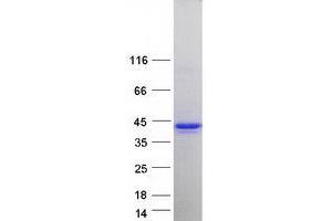 Western Blotting (WB) image for Heme Oxygenase (Decycling) 2 (HMOX2) (Transcript Variant 2) protein (Myc-DYKDDDDK Tag) (ABIN2722597)