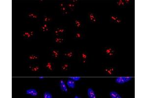 Confocal immunofluorescence analysis of U2OS cells using DDX21 Polyclonal Antibody at dilution of 1:100. (DDX21 抗体)