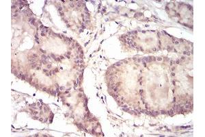 Immunohistochemistry (IHC) image for anti-Eukaryotic Translation Initiation Factor 5A (EIF5A) (AA 1-154) antibody (ABIN5542611)