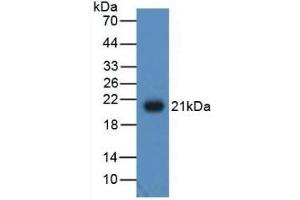Detection of Recombinant ADP, Human using Polyclonal Antibody to Adiponectin (ADPN) (ADIPOQ 抗体  (AA 108-244))