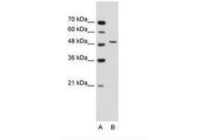 Image no. 3 for anti-Semenogelin I (SEMG1) (AA 51-100) antibody (ABIN203500) (SEMG1 抗体  (AA 51-100))