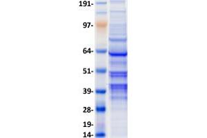 Validation with Western Blot