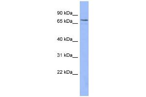 WB Suggested Anti-PATZ1 Antibody Titration:  0. (PATZ1 抗体  (N-Term))