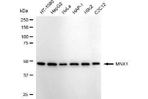 anti-Motor Neuron and Pancreas Homeobox 1 (MNX1) antibody