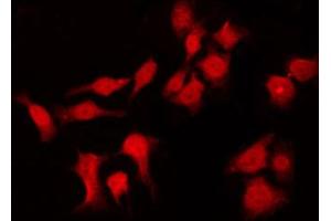 ABIN6266566 staining HuvEc by IF/ICC. (Involucrin 抗体)