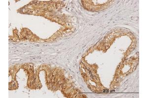 Immunoperoxidase of purified MaxPab antibody to LITAF on formalin-fixed paraffin-embedded human prostate. (LITAF 抗体  (AA 1-161))