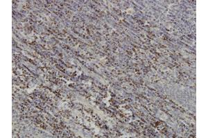 Immunoperoxidase of monoclonal antibody to PAX5 on formalin-fixed paraffin-embedded human tonsil. (PAX5 抗体  (AA 192-301))