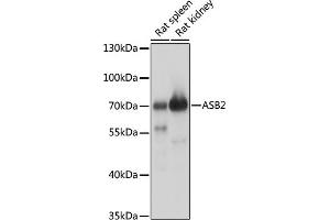 Western blot analysis of extracts of various cell lines, using  antibody (ABIN7265612) at 1:1000 dilution. (ASB2 抗体  (AA 448-587))