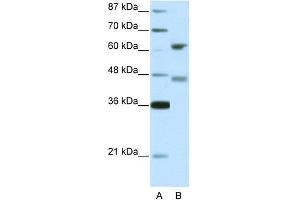 Human 293T; WB Suggested Anti-RFX4 Antibody Titration: 5. (RFX4 抗体  (Middle Region))