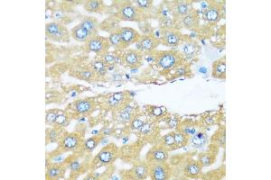 Immunohistochemistry of paraffin-embedded mouse liver using  antibody (ABIN6129195, ABIN6137096, ABIN6137097 and ABIN6220538) at dilution of 1:100 (40x lens). (ARHGEF5 抗体  (AA 1248-1597))