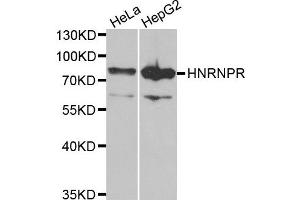 Western blot analysis of extracts of HeLa and HepG2 cell lines, using HNRNPR antibody. (HNRNPR 抗体)