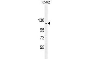 ARHGAP17 Antibody (N-term) western blot analysis in K562 cell line lysates (35µg/lane). (ARHGAP17 抗体  (N-Term))