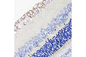 Immunohistochemistry of paraffin-embedded rat retina using DRD4 antibody (ABIN1679595, ABIN5663875, ABIN5663877 and ABIN6217338) at dilution of 1:100 (40x lens). (DRD4 抗体  (AA 100-200))