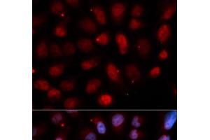Immunofluorescence analysis of U2OS cells using Pea3 / ETV4 Polyclonal Antibody (ETV4 抗体)