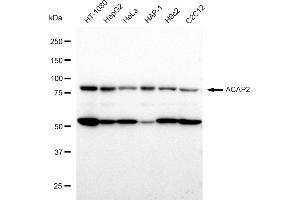 Western blotting analysis using ACAP2 antibody (ABIN7797642).