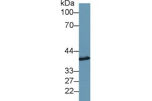 Detection of SYTL2 in Porcine Cerebrum lysate using Polyclonal Antibody to Synaptotagmin Like Protein 2 (SYTL2) (SYTL2 抗体  (AA 329-880))