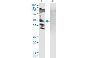 Western Blot analysis of RSC1A1 expression in transfected 293T cell line by RSC1A1 MaxPab polyclonal antibody. (RSC1A1 抗体  (AA 1-617))