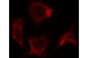 ABIN6278180 staining 293T by IF/ICC. (SOCS2 抗体)