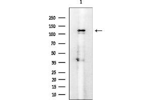 Western blot analysis of lysates from Mouse spleen, using EPB41L3 Mouse Monoclonal Antibody at 1/1000 dilution.