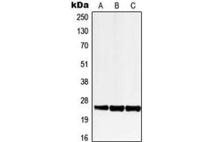 Western blot analysis of LRAT expression in HEK293T (A), SP2/0 (B), H9C2 (C) whole cell lysates. (LRAT 抗体  (Center))