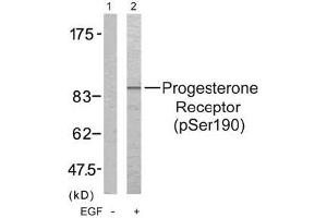 Image no. 3 for anti-Progesterone Receptor (PGR) (pSer190) antibody (ABIN196746) (Progesterone Receptor 抗体  (pSer190))
