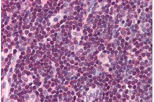 Human Small Intestine, Peyer's Patch (formalin-fixed, paraffin-embedded) stained with IRF8 antibody ABIN214504 at 5 ug/ml followed by biotinylated goat anti-rabbit IgG secondary antibody ABIN481713, alkaline phosphatase-streptavidin and chromogen. (IRF8 抗体  (C-Term))
